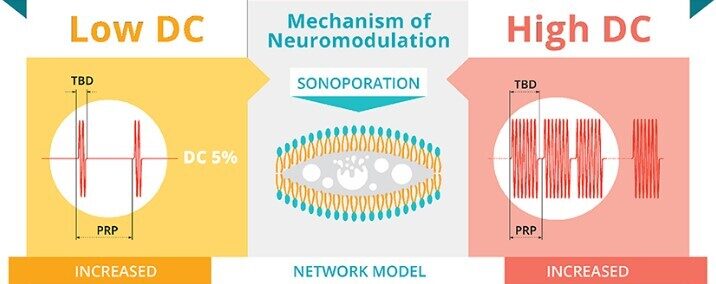 A diagram showing how ultrasound for neuromodulation works