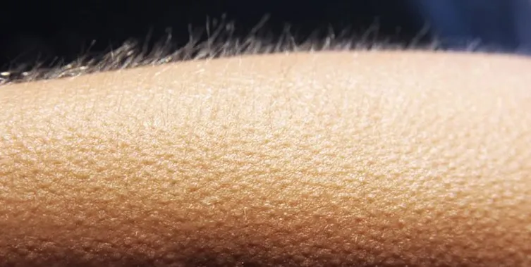 Why Do We Experience Chills?